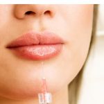 Diseño y Volumen de Labios | Labios Rusos | Hidratacion Labial en Biomedical Dental Badajoz